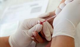 Specialistai: Lietuvoje hepatitas B turėtų būti vertinamas rimčiau