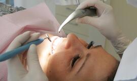 Odontologė: balti dantys - nebūtinai sveiki