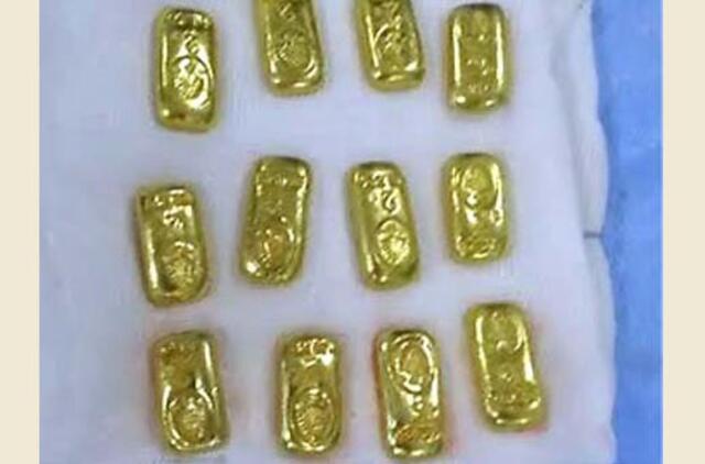 Indijoje medikai iš vyro žarnyno išoperavo kelis šimtus gramų aukso