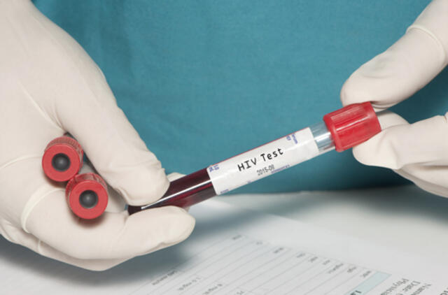 2015 metais ŽIV infekcija diagnozuota 157 asmenims