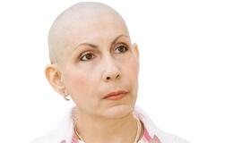 Kiaušidžių vėžio diagnozę kasmet išgirsta 400-450 moterų