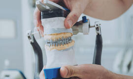 Dantų protezavimas - vis dar skaudi tema