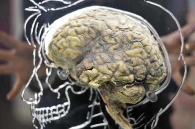 Gilios komos ištiktose smegenyse atrado nežinomą aktyvumo formą